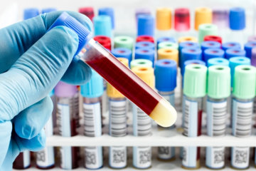 Как правильно расшифровать анализ крови