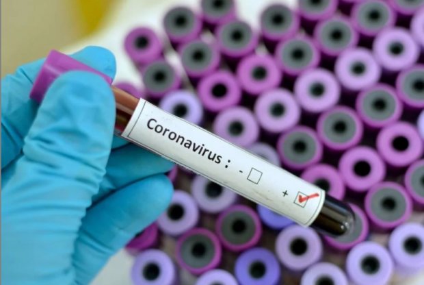Тест на коронавирус. Фото: 112.ua