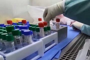 У двух граждан Кипра обнаружили коронавирус. Фото: скриншот YouTube