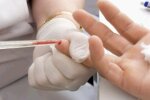 Гепатит А в Україні: все що потрібно знати про вірус, симптоми, вакцину та правила безпеки