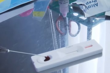 В Украине COVID-19 диагностируют тест-системами из частных лабораторий. Фото: скриншот YouTube