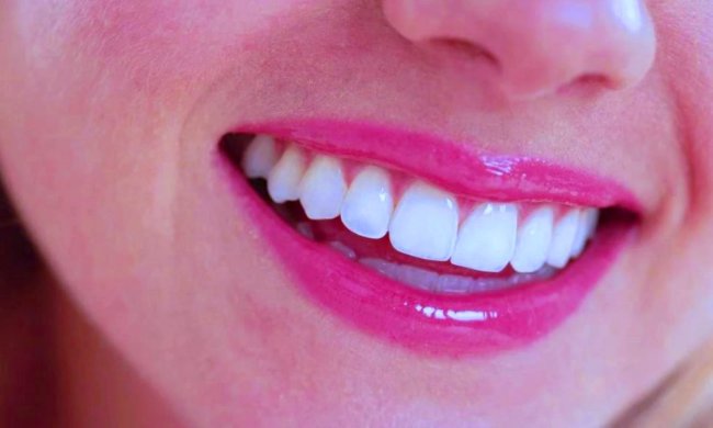 Здоровые зубы, фото: Yandex Zen - Яндекс