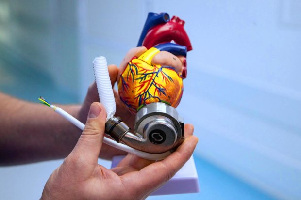 Механическое сердце, фото: пресс-служба КГГА
