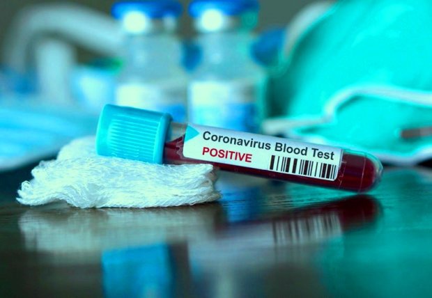 Тест на коронавирус. Фото: ФПБ