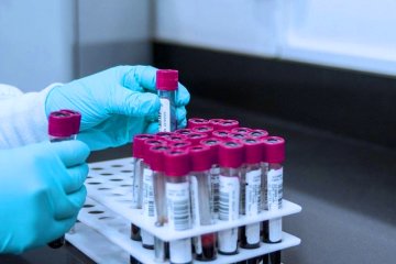 Тестирование на коронавирус. Фото: Новости Каменского