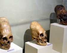 В России нашли череп "Чужого". Появилось необычное фото. Говорят, что ему было 30