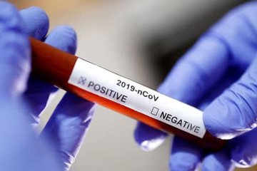 Тест на коронавирус. Фото: pravda.com.ua