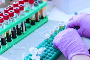 Тестирование на коронавирус. Фото: Новое Время