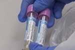 В Минздраве объяснили, почему на Covid-19 тестируют не всех украинцев. Фото: скриншот YouTube