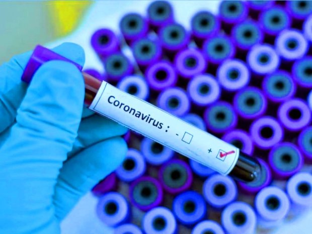 Тест-системы на коронавирус, фото: 112 Украина