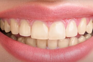 Зуби. Фото: YouTube