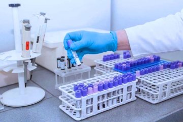 Тест на коронавирус. Фото: Вести